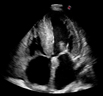 cardiology-thumb.jpg