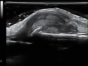 Finger_13_300.jpg
